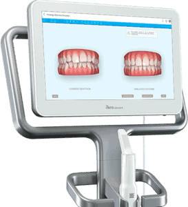 digital smile design Liverpool