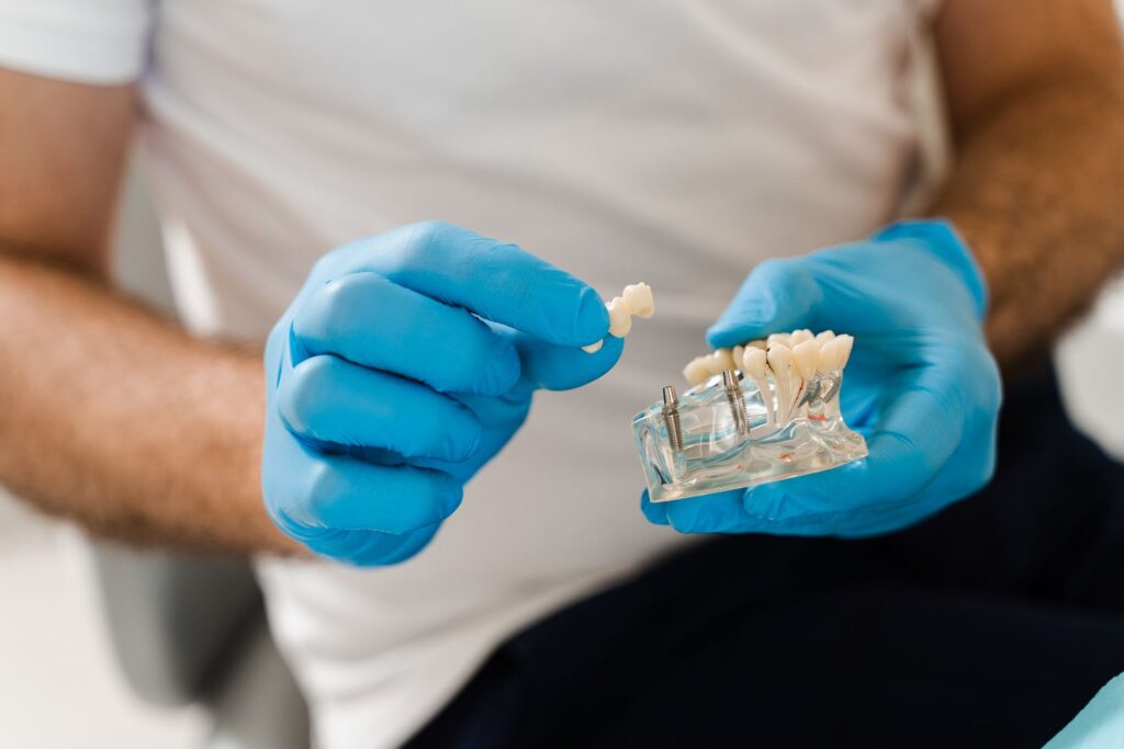 teeth replacement Liverpool
